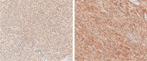 Immunohistochemistry (Formalin/PFA-fixed paraffin-embedded sections) - Anti-V5 tag antibody (AB95038), expandable thumbnail