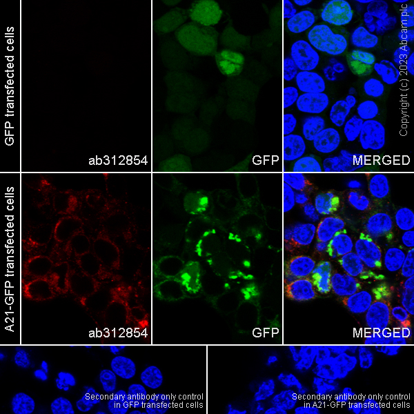 Immunocytochemistry/ Immunofluorescence - Anti-Vaccinia Virus antibody [EPR28236-80] (AB312854)