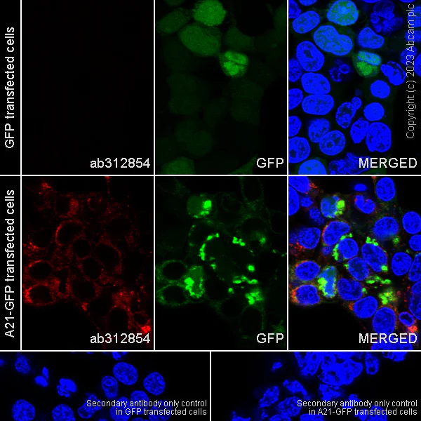 Immunocytochemistry/ Immunofluorescence - Anti-Vaccinia Virus antibody [EPR28236-80] (AB312854)