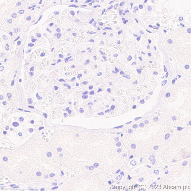 Immunohistochemistry (Formalin/PFA-fixed paraffin-embedded sections) - Anti-Vaccinia Virus antibody [EPR28236-80] (AB312854)