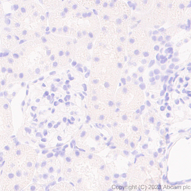 Immunohistochemistry (Formalin/PFA-fixed paraffin-embedded sections) - Anti-Vaccinia Virus antibody [EPR28236-80] (AB312854)
