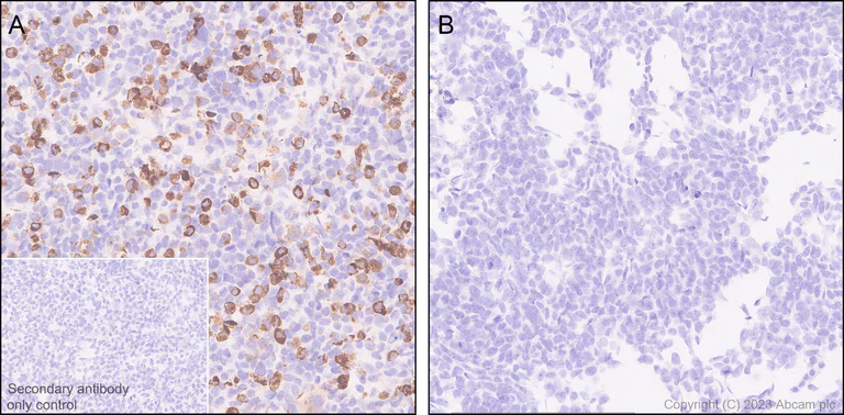 Immunohistochemistry (Formalin/PFA-fixed paraffin-embedded sections) - Anti-Vaccinia Virus antibody [EPR28236-80] - BSA and Azide free (AB312855)