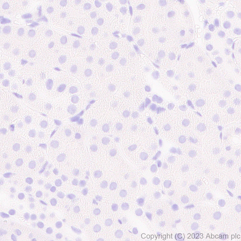 Immunohistochemistry (Formalin/PFA-fixed paraffin-embedded sections) - Anti-Vaccinia Virus antibody [EPR28236-80] - BSA and Azide free (AB312855)