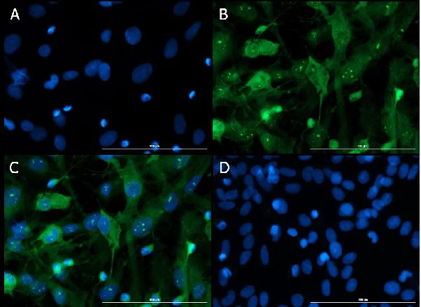 Immunocytochemistry/ Immunofluorescence - Anti-VAChT antibody (AB235201)