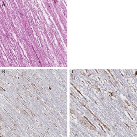 Immunohistochemistry (Formalin/PFA-fixed paraffin-embedded sections) - Anti-VAChT antibody (AB235201), expandable thumbnail