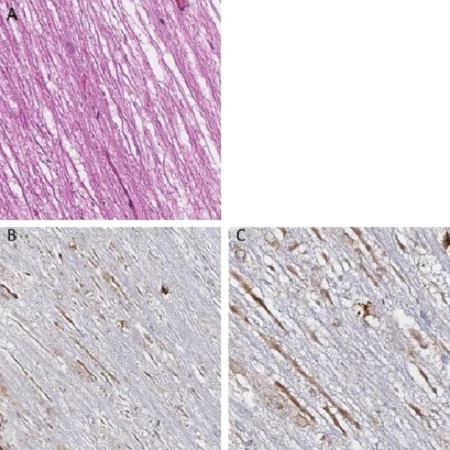 Immunohistochemistry (Formalin/PFA-fixed paraffin-embedded sections) - Anti-VAChT antibody (AB235201)