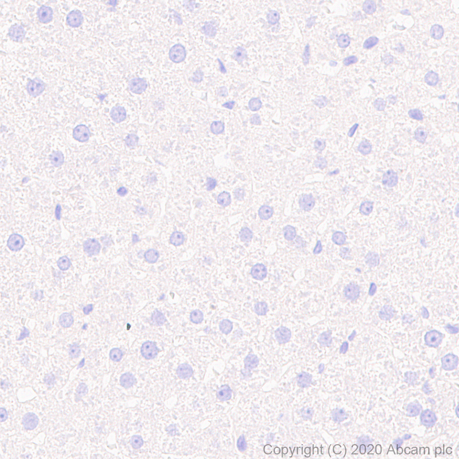 Immunohistochemistry (Formalin/PFA-fixed paraffin-embedded sections) - Anti-VAChT antibody [EPR24248-167] (ab271111), expandable thumbnail