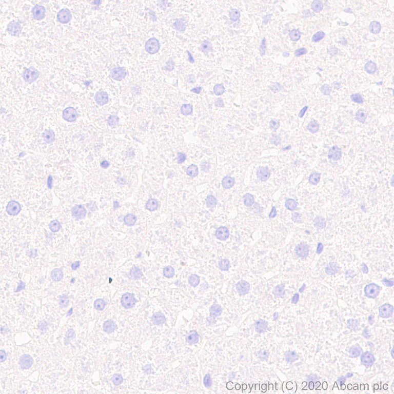 Immunohistochemistry (Formalin/PFA-fixed paraffin-embedded sections) - Anti-VAChT antibody [EPR24248-167] (AB271111)