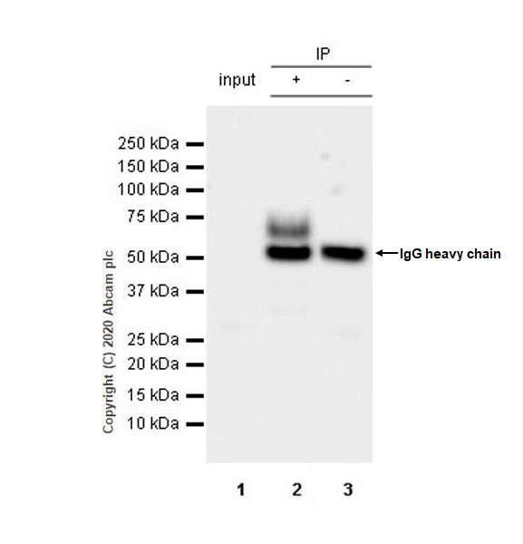 Immunoprecipitation - Anti-VAChT antibody [EPR24248-167] (AB271111), expandable thumbnail