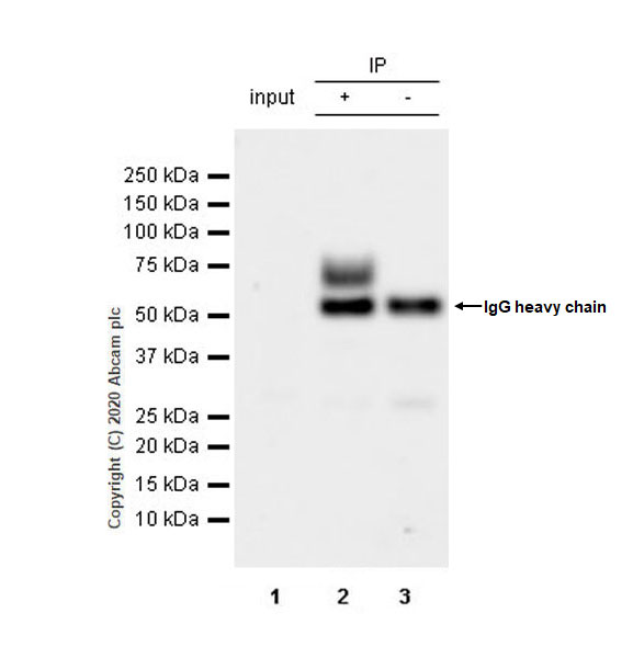 Immunoprecipitation - Anti-VAChT antibody [EPR24248-167] (AB271111), expandable thumbnail