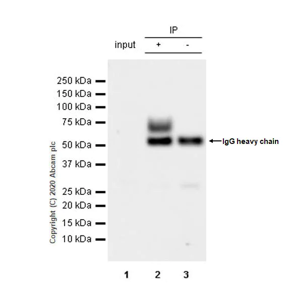 Immunoprecipitation - Anti-VAChT antibody [EPR24248-167] - BSA and Azide free (AB279710)