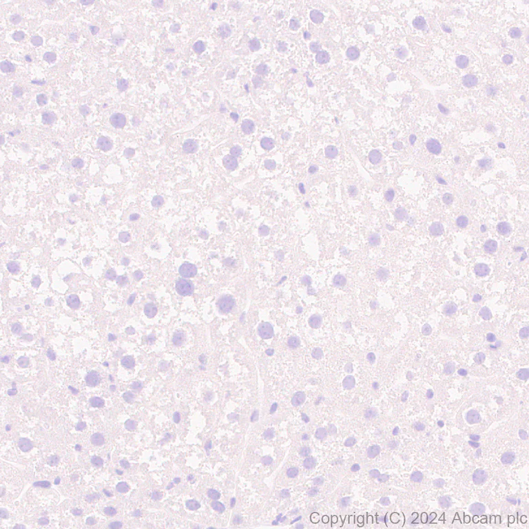 Immunohistochemistry (Formalin/PFA-fixed paraffin-embedded sections) - Anti-VAChT antibody [EPR29154-71] (AB317452)