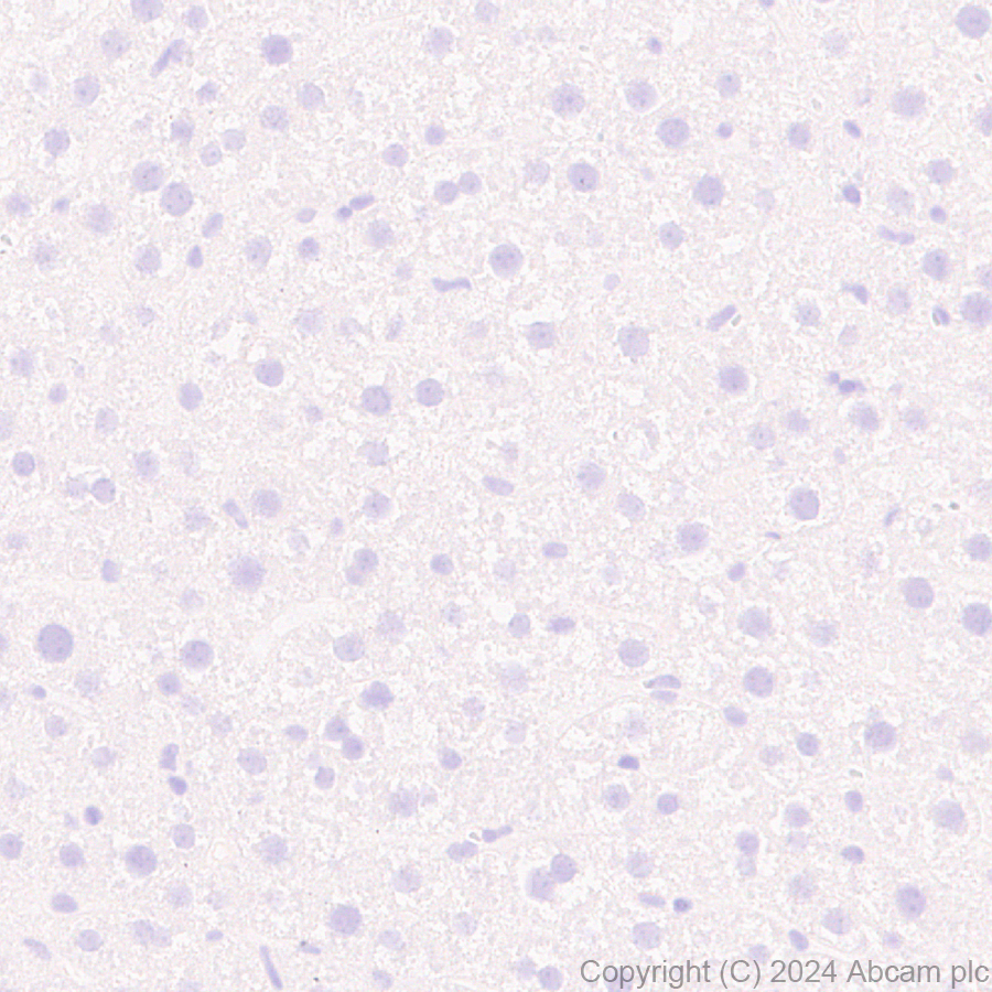 Immunohistochemistry (Formalin/PFA-fixed paraffin-embedded sections) - Anti-VAChT antibody [EPR29154-71] (AB317452)