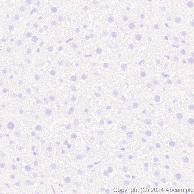 Immunohistochemistry (Formalin/PFA-fixed paraffin-embedded sections) - Anti-VAChT antibody [EPR29154-71] (AB317452)