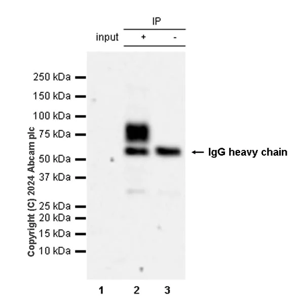 Immunoprecipitation - Anti-VAChT antibody [EPR29154-71] (AB317452)