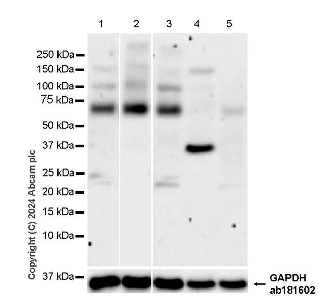 Western blot - Anti-VAChT antibody [EPR29154-71] (AB317452)