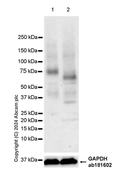 Western blot - Anti-VAChT antibody [EPR29154-71] (AB317452)