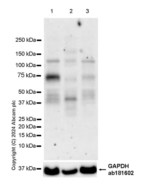 Western blot - Anti-VAChT antibody [EPR29154-71] (AB317452)