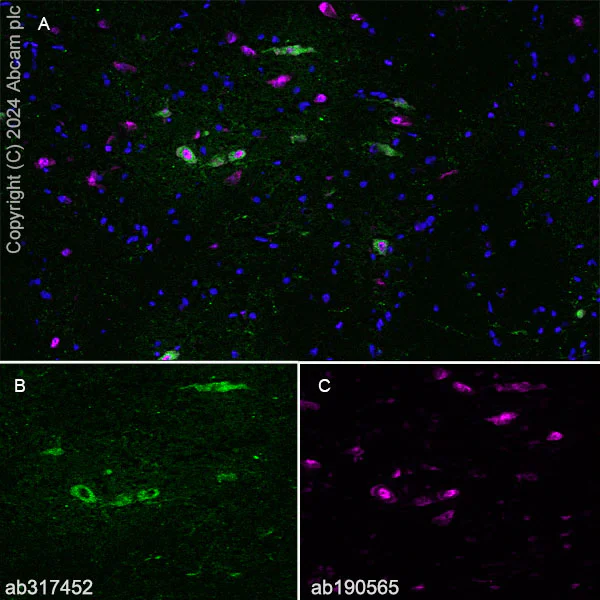 Immunohistochemistry (Frozen sections) - Anti-VAChT antibody [EPR29154-71] - BSA and Azide free (AB317453)