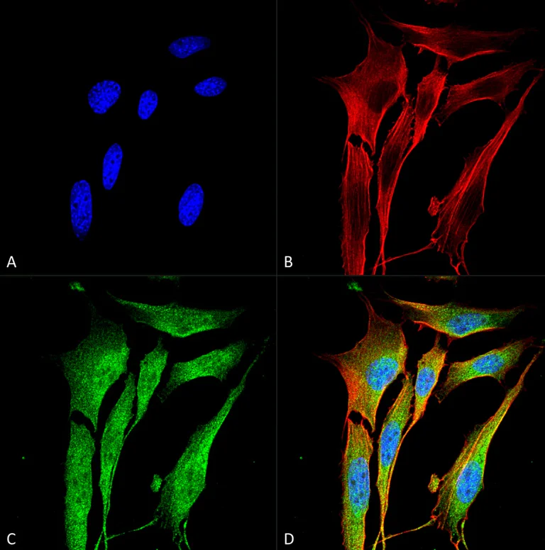 Immunocytochemistry/ Immunofluorescence - Anti-VAChT antibody [S6] (AB326355)