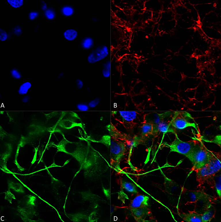 Immunocytochemistry/ Immunofluorescence - Anti-VAChT antibody [S6] (AB326355)