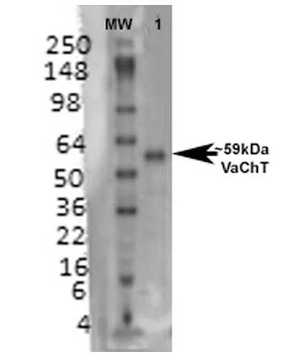 Western blot - Anti-VAChT antibody [S6] (AB326355)