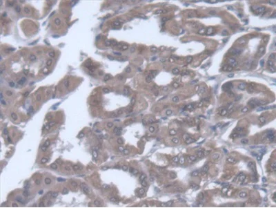 Immunohistochemistry (Formalin/PFA-fixed paraffin-embedded sections) - Anti-valyl tRNA synthetase antibody (AB231711)