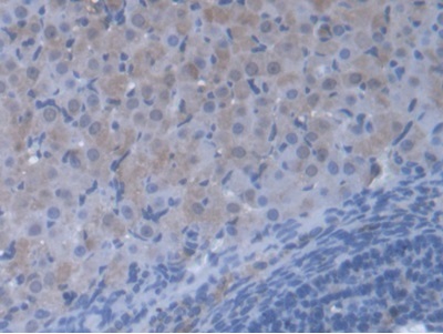Immunohistochemistry (Formalin/PFA-fixed paraffin-embedded sections) - Anti-valyl tRNA synthetase antibody (AB231711)