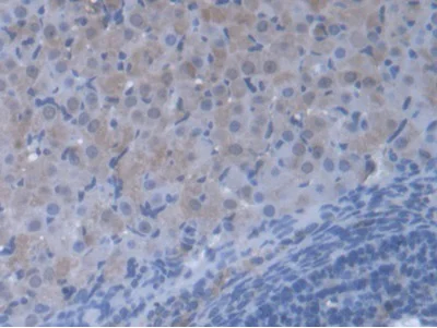 Immunohistochemistry (Formalin/PFA-fixed paraffin-embedded sections) - Anti-valyl tRNA synthetase antibody (AB231711)