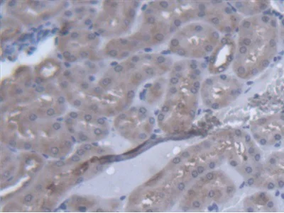 Immunohistochemistry (Formalin/PFA-fixed paraffin-embedded sections) - Anti-valyl tRNA synthetase antibody (AB231711)