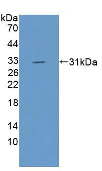 Western blot - Anti-valyl tRNA synthetase antibody (AB231711)