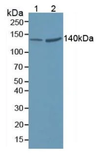 Western blot - Anti-valyl tRNA synthetase antibody (AB231711)