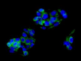 Immunocytochemistry/ Immunofluorescence - Anti-valyl tRNA synthetase antibody [EPR11300] - BSA and Azide free (AB250401), expandable thumbnail