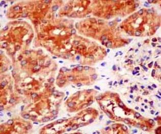 Immunohistochemistry (Formalin/PFA-fixed paraffin-embedded sections) - Anti-valyl tRNA synthetase antibody [EPR11300] - BSA and Azide free (AB250401)