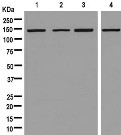 Western blot - Anti-valyl tRNA synthetase antibody [EPR11300] - C-terminal (AB181175)