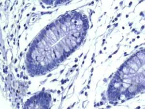 Immunohistochemistry (Formalin/PFA-fixed paraffin-embedded sections) - Anti-VAMP1 antibody [EPR7325(2)] - BSA and Azide free (AB249031)
