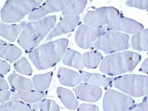 Immunohistochemistry (Formalin/PFA-fixed paraffin-embedded sections) - Anti-VAMP1 antibody [EPR7325(2)] - BSA and Azide free (AB249031), expandable thumbnail