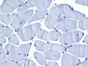 Immunohistochemistry (Formalin/PFA-fixed paraffin-embedded sections) - Anti-VAMP1 antibody [EPR7325(2)] - BSA and Azide free (AB249031)