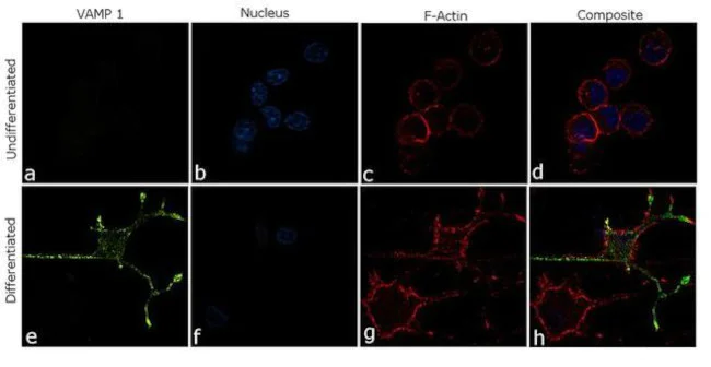 Immunocytochemistry/ Immunofluorescence - Anti-VAMP1 antibody [RP23040244] (AB308137)