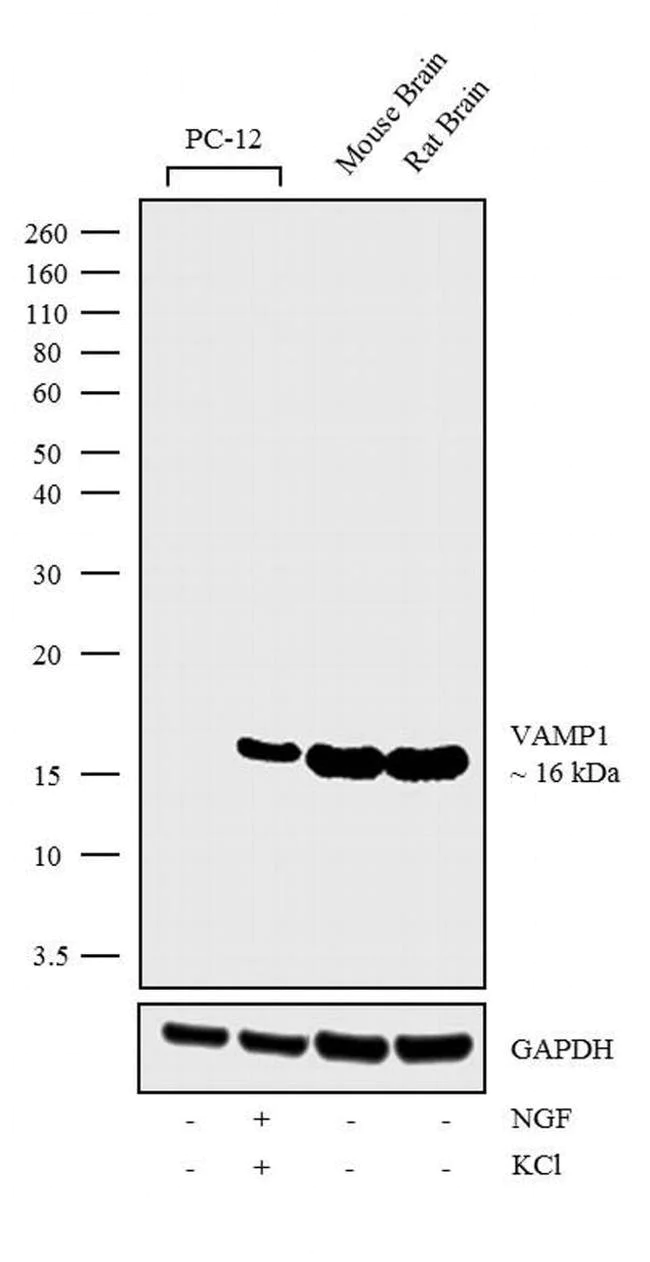 Western blot - Anti-VAMP1 antibody [RP23040244] (AB308137)