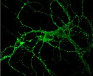 Immunocytochemistry/ Immunofluorescence - Anti-VAMP2 antibody [6F9] - N-terminal (AB181754)