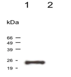 Western blot - Anti-VAMP2 antibody [6F9] - N-terminal (AB181754)