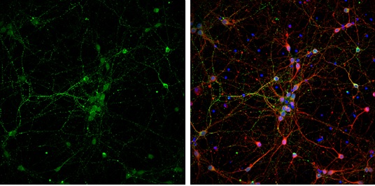 Immunocytochemistry/ Immunofluorescence - Anti-VAMP2 antibody (AB228996), expandable thumbnail