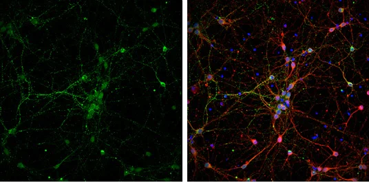 Immunocytochemistry/ Immunofluorescence - Anti-VAMP2 antibody (AB228996)