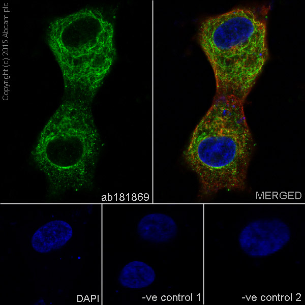 Immunocytochemistry/ Immunofluorescence - Anti-VAMP2 antibody [EPR12790] (ab181869), expandable thumbnail