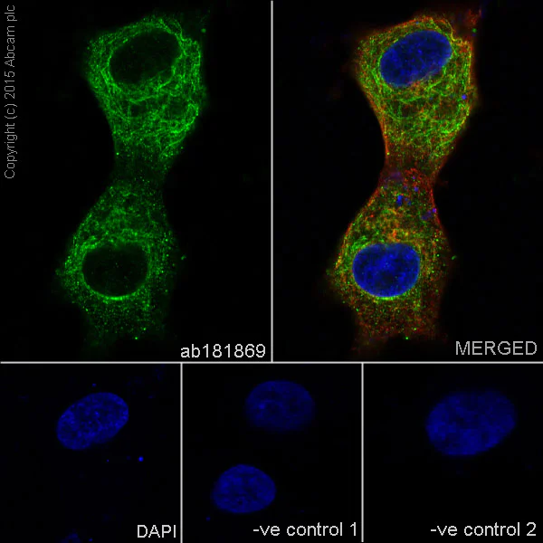 Immunocytochemistry/ Immunofluorescence - Anti-VAMP2 antibody [EPR12790] (AB181869)