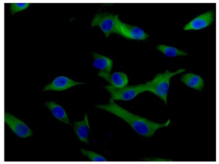 Immunocytochemistry/ Immunofluorescence - Anti-VAMP2 antibody [EPR12790] (AB181869), expandable thumbnail