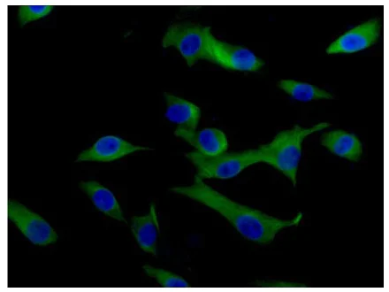 Immunocytochemistry/ Immunofluorescence - Anti-VAMP2 antibody [EPR12790] (AB181869)