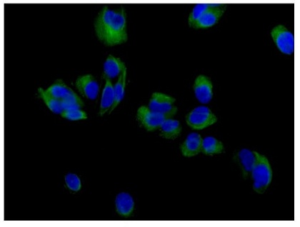 Immunocytochemistry/ Immunofluorescence - Anti-VAMP2 antibody [EPR12790] (ab181869), expandable thumbnail