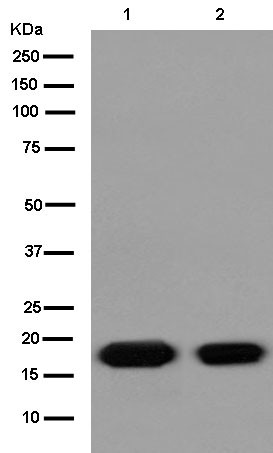 Western blot - Anti-VAMP2 antibody [EPR12790] (ab181869), expandable thumbnail